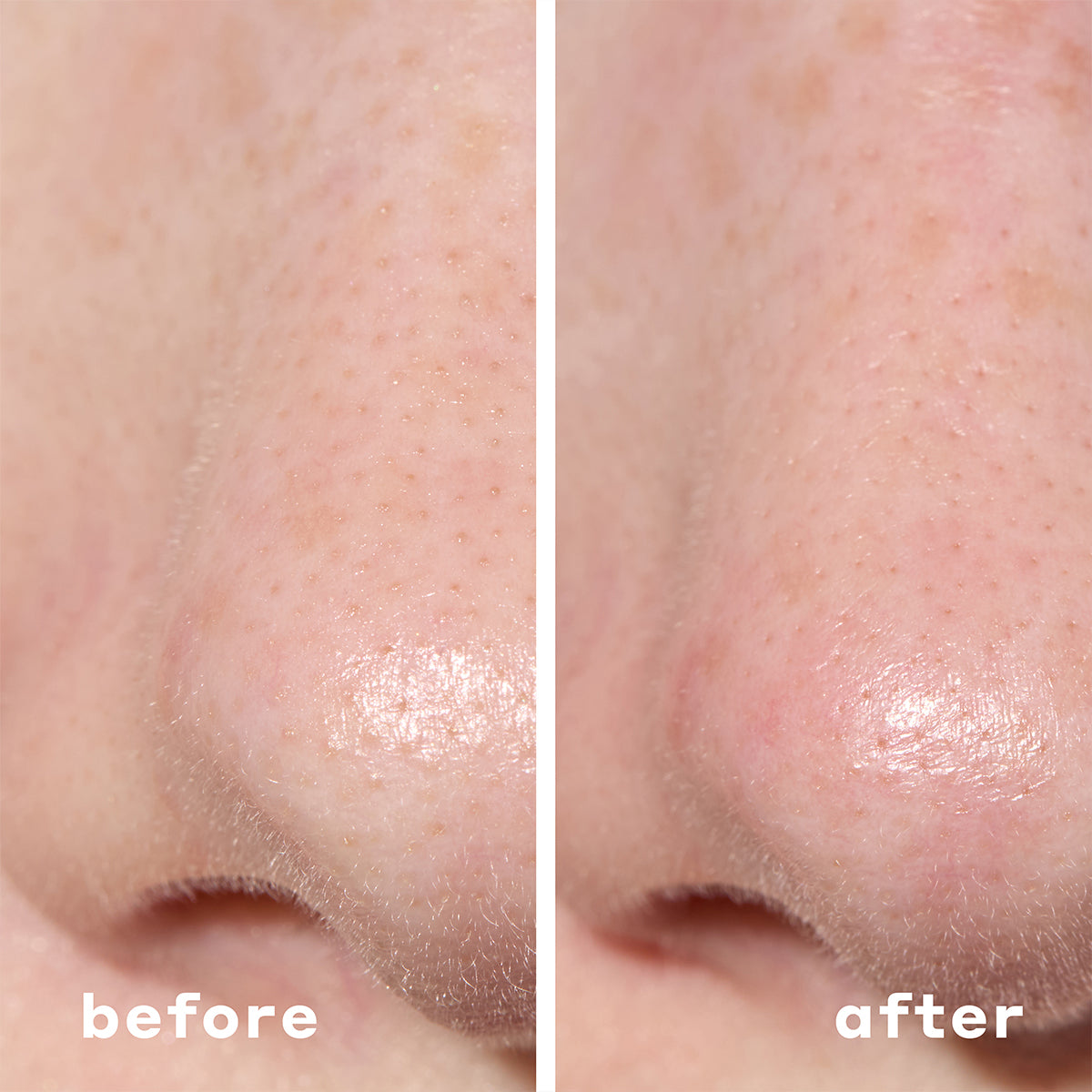 Mario Badescu - 2-In-1 Deep Cleansing Pore Strip
