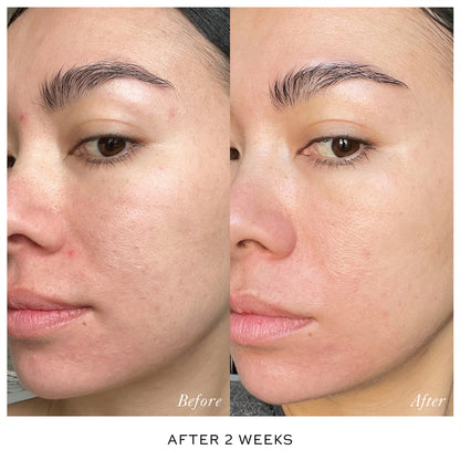 Westman Atelier - Skin Activator - Serum Duo